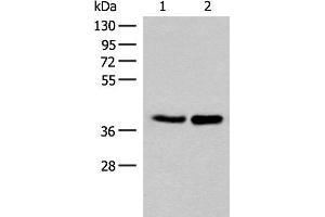 Western blot analysis of HUVEC and PC3 cell lysates using FAM84B Polyclonal Antibody at dilution of 1:400 (FAM84B 抗体)