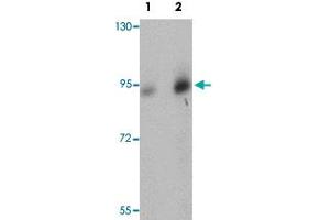 Western blot analysis of human brain tissue with DCLK1 polyclonal antibody  at (Lane 1) 0. (DCLK1 抗体  (N-Term))