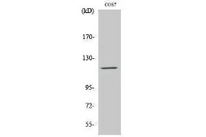 Western Blotting (WB) image for anti-PTK2B Protein tyrosine Kinase 2 beta (PTK2B) (Ser373) antibody (ABIN3186607) (PTK2B 抗体  (Ser373))