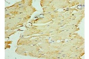 Immunohistochemistry of paraffin-embedded human skeletal muscle tissue using ABIN7162696 at dilution of 1:100 (PNPLA2 抗体  (AA 265-504))