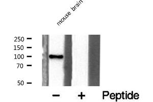 Western blot analysis of extracts from mouse brain cells, using GCN5L2 antibody. (KAT2A 抗体  (C-Term))