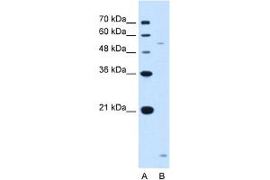 WB Suggested Anti-ST3GAL5 Antibody Titration:  1.