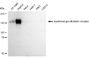 Western blotting analysis using Epidermal growth factor receptor antibody (ABIN7798476). (EGFR 抗体)