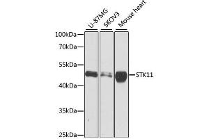 Western blot analysis of extracts of various cell lines, using STK11 antibody.