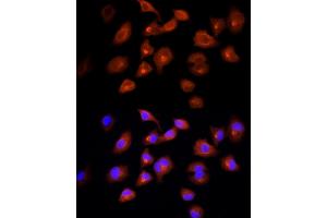 Immunofluorescence analysis of A-549 cells using DBI Rabbit pAb (ABIN6127407, ABIN6139420, ABIN6139422 and ABIN6217234) at dilution of 1:100 (40x lens).