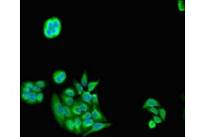 Immunofluorescent analysis of PC-3 cells using ABIN7142238 at dilution of 1:100 and Alexa Fluor 488-congugated AffiniPure Goat Anti-Rabbit IgG(H+L) (PSMC5 抗体  (Regulatory Subunit 8))