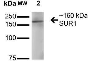 Western Blot analysis of Rat Brain Membrane showing detection of ~160 kDa SUR1 protein using Mouse Anti-SUR1 Monoclonal Antibody, Clone S289-16 . (ABCC8 抗体  (AA 1548-1582) (Atto 594))