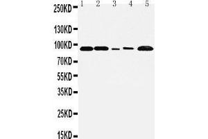 Anti-FGFR1 antibody, Western blotting Lane 1: Rat Liver Tissue Lysate Lane 2: Rat Brain Tissue Lysate Lane 3: SMMC Cell Lysate Lane 4:  Cell Lysate Lane 5: MM231 Cell Lysate (FGFR1 抗体  (C-Term))