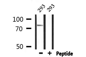 Western blot analysis of extracts from 293, using ADD3 Antibody. (ADD3 抗体  (Internal Region))