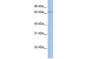 MAP3K2 antibody used at 1 ug/ml to detect target protein. (MAP3K2 抗体  (N-Term))