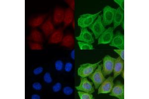 ABIN6258706 and ABIN6274819 staining Hela cells(45 min of heat-shock) by IF/ICC.