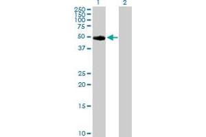 Western Blot analysis of TYR expression in transfected 293T cell line by TYR MaxPab polyclonal antibody. (TYR 抗体  (AA 1-377))