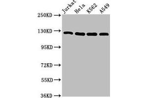 Western Blot Positive WB detected in: Jurkat whole cell lysate, Hela whole cell lysate, K562 whole cell lysate, A549 whole cell lysate All lanes: POLD1 antibody at 5 μg/mL Secondary Goat polyclonal to rabbit IgG at 1/50000 dilution Predicted band size: 124 kDa Observed band size: 124 kDa (POLD1 抗体  (Catalytic Subunit))