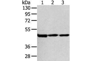 Western Blotting (WB) image for anti-1-Acylglycerol-3-Phosphate O-Acyltransferase 9 (AGPAT9) antibody (ABIN5960644) (AGPAT9 抗体)
