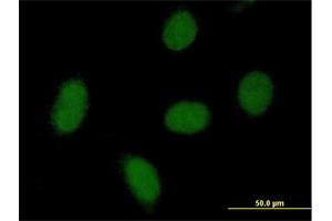 Immunofluorescence of purified MaxPab antibody to C9orf152 on HeLa cell. (C9orf152 抗体  (AA 1-218))
