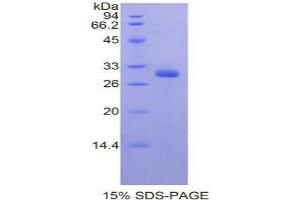 SDS-PAGE analysis of Mouse PRDM1 Protein. (PRDM1 蛋白)