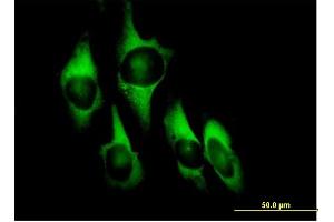 Immunofluorescence (IF) image for anti-Eukaryotic Translation Elongation Factor 1 delta (Guanine Nucleotide Exchange Protein) (EEF1D) (AA 1-281) antibody (ABIN515169)