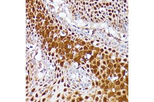 Immunohistochemistry of paraffin-embedded human esophageal using CLNS1A antibody (ABIN7266334) at dilution of 1:100 (40x lens).