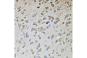 Immunohistochemistry of paraffin-embedded mouse brain using MPO antibody (ABIN4904410) at dilution of 1:100 (40x lens). (Myeloperoxidase 抗体)