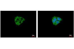 ICC/IF Image DCAMKL2 antibody [N2C2], Internal detects DCAMKL2 protein at Cytoplasm by immunofluorescent analysis.
