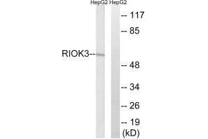 Western blot analysis of extracts from HepG2 cells, using RIOK3 antibody. (RIOK3 抗体)