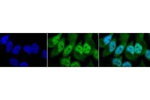 Immunocytochemistry/Immunofluorescence analysis using Rabbit Anti-Phosphothreonine Polyclonal Antibody (ABIN361757).