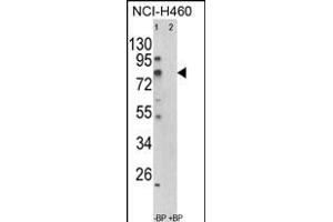 Western blot analysis of ACSS3 Antibody (Center) (ABIN652520 and ABIN2842349) in NCI- cell line lysates (35 μg/lane). (ACSS3 抗体  (AA 224-251))