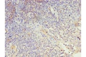 Immunohistochemistry of paraffin-embedded human tonsil tissue using ABIN7158082 at dilution of 1:100 (LRRN1 抗体  (AA 26-631))