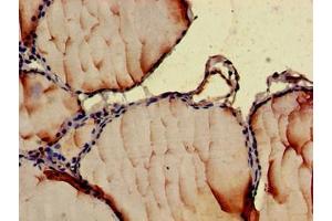 Immunohistochemistry of paraffin-embedded human thyroid tissue using ABIN7145998 at dilution of 1:100 (CCL3 抗体  (AA 25-81))