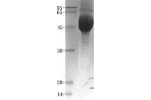 Validation with Western Blot (CRTAM Protein (His tag))