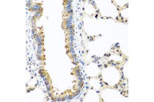 Immunohistochemistry of paraffin-embedded rat lung using C8orf4 antibody at dilution of 1:100 (40x lens). (C8orf4 抗体)