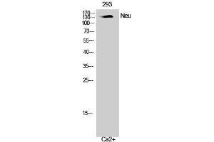 Western Blotting (WB) image for anti-Neuralized Homolog (Drosophila) (NEURL) (Ser351) antibody (ABIN3185827)