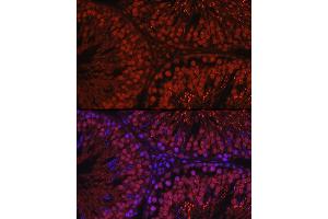 Immunofluorescence analysis of rat testis using C1orf146 Rabbit pAb (ABIN7266368) at dilution of 1:100 (40x lens). (C1ORF146 抗体)