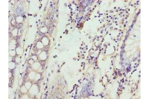 Immunohistochemistry (IHC) image for anti-Serine Palmitoyltransferase, Long Chain Base Subunit 3 (SPTLC3) (AA 1-58) antibody (ABIN7168900)