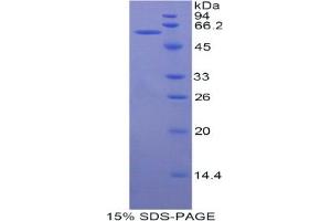 SDS-PAGE analysis of Human MACC1 Protein. (MACC1 蛋白)