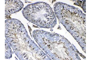 IHC analysis of FMN1 using anti-FMN1 antibody . (FMN1 抗体  (AA 1195-1419))