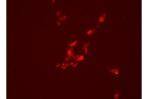 Immunofluorescence (fixed cells) (IF/ICC) image for anti-Promyelocytic Leukemia (PML) (N-Term) antibody (ABIN6264315)