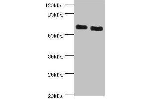 Western blot All lanes: ATAD3B antibody at 2 μg/mL Lane 1: Jurkat whole cell lysate Lane 2: Hela whole cell lysate Secondary Goat polyclonal to rabbit IgG at 1/10000 dilution Predicted band size: 73, 20, 68 kDa Observed band size: 73 kDa (ATAD3B 抗体  (AA 1-240))