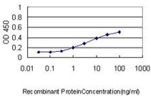 anti-ATPase, Cu++ Transporting, beta Polypeptide (ATP7B) (AA 1372-1465) antibody