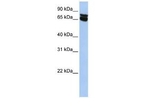 B4GALNT1 antibody used at 1 ug/ml to detect target protein. (B4GALNT1 抗体  (N-Term))