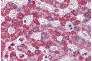 Human Liver: Formalin-Fixed, Paraffin-Embedded (FFPE) (ALDH5A1 抗体  (C-Term))