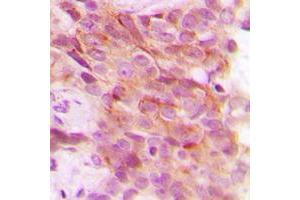 Immunohistochemistry (IHC) image for anti-Proteasome (Prosome, Macropain) 26S Subunit, Non-ATPase, 12 (PSMD12) (Center) antibody (ABIN7296742)