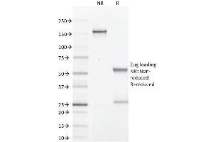 SDS-PAGE (SDS) image for anti-Prolactin-Induced Protein (PIP) (AA 41-146) antibody (ABIN6940316)