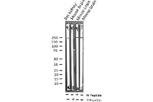 Western blot analysis of Phospho-WNK1 (Thr58) expression in various lysates (WNK1 抗体  (pThr60))
