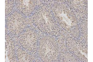 Immunohistochemistry (IHC) image for anti-Cytidine Deaminase (CDA) antibody (ABIN1871668) (CDA 抗体)
