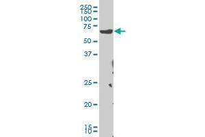 CHEK2 monoclonal antibody (M04), clone 4F10 Western Blot analysis of CHEK2 expression in Hela S3 NE . (CHEK2 抗体  (AA 1-543))
