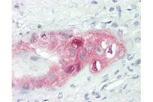 Human Placenta: Formalin-Fixed, Paraffin-Embedded (FFPE) (CCDC6 抗体  (AA 1-232))