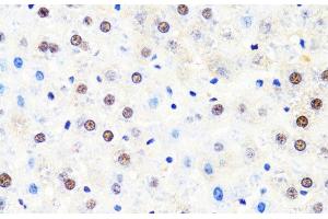 Immunohistochemistry of paraffin-embedded Rat liver using POLR2B Polyclonal Antibody at dilution of 1:100 (40x lens). (POLR2B 抗体)
