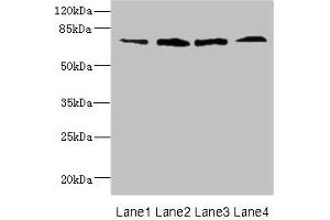 Western blot All lanes: DARS2 antibody at 16 μg/mL Lane 1: Mouse heart tissue Lane 2: Mouse liver tissue Lane 3: Mouse brain tissue Lane 4: Mouse skeletal muscle tissue Secondary Goat polyclonal to rabbit IgG at 1/10000 dilution Predicted band size: 73 kDa Observed band size: 73 kDa (FLRT3 抗体  (AA 209-264))
