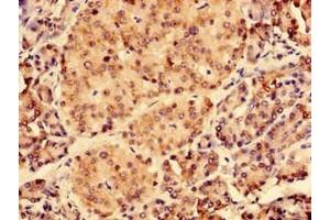 Immunohistochemistry of paraffin-embedded human pancreatic tissue using ABIN7147383 at dilution of 1:100 (CEP126 抗体  (AA 559-670))